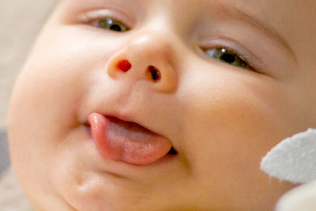 Understanding the Tongue's Remarkable Healing Process and Injury Care